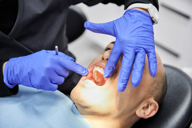 Best Emergency Dentist for Lost Fillings or Crowns in Hughestown, PA